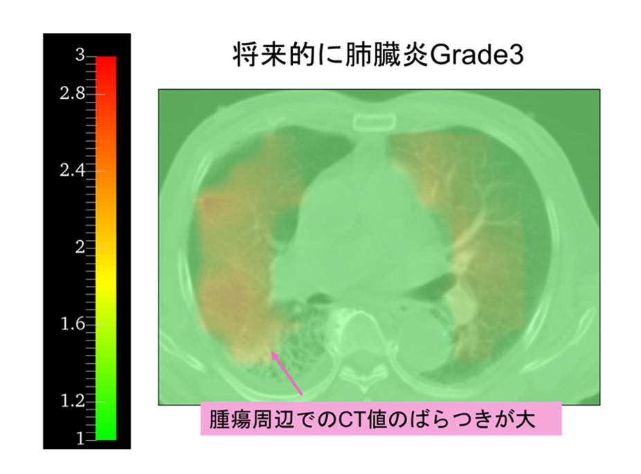 広島大学放射線腫瘍学医学物理グループ